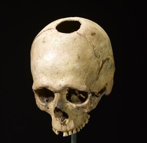 Mennesker - Deres kost, helbred og oprindelse i Oldtiden